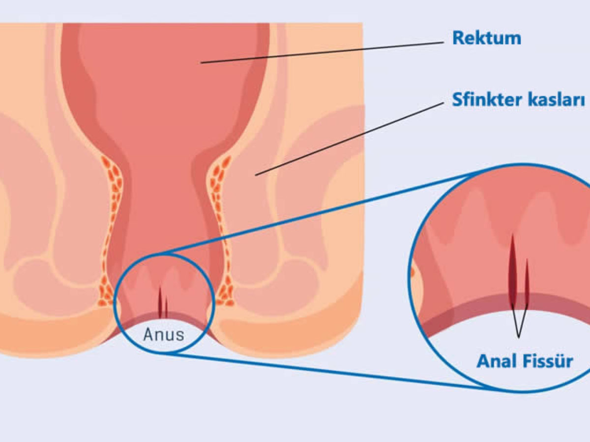 Ogiz jinsiy aloqada gepatit - cheksizlikning faol tomoni