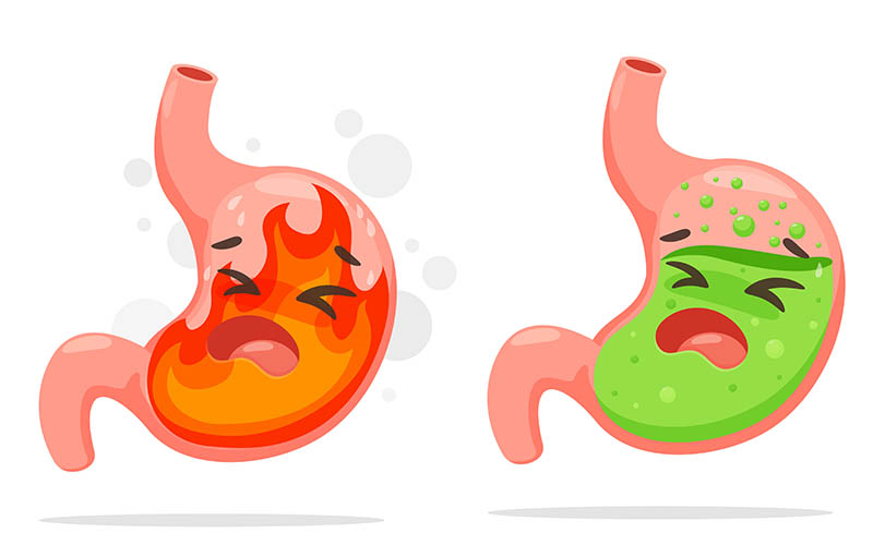 Symptoms of Gastric Ulcer