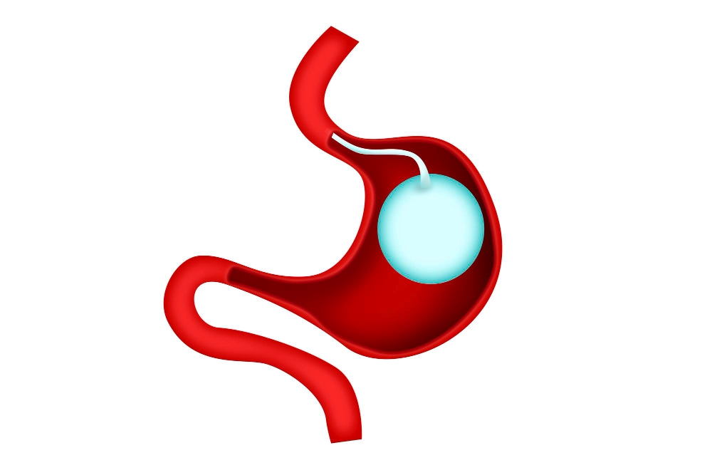 mide balonu fiyatları